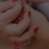 Does Health Insurance Cover Breast Reduction Surgery?